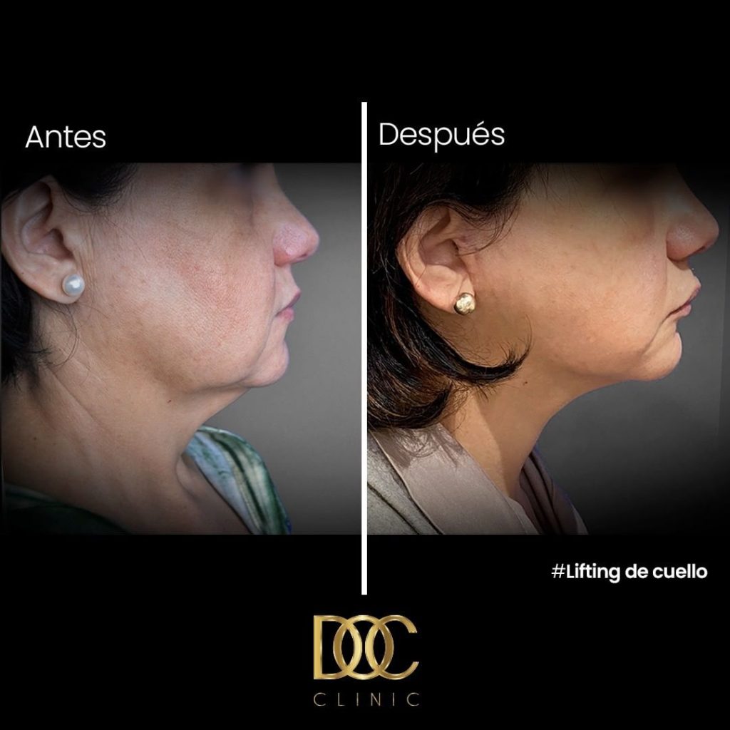 Snapinsta.app_313644542_1138422546773162_4925335463688615466_n_1080