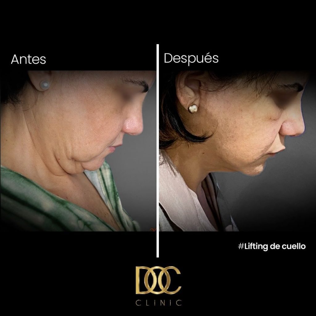 Snapinsta.app_313858327_1183242479289252_7801707593360103161_n_1080