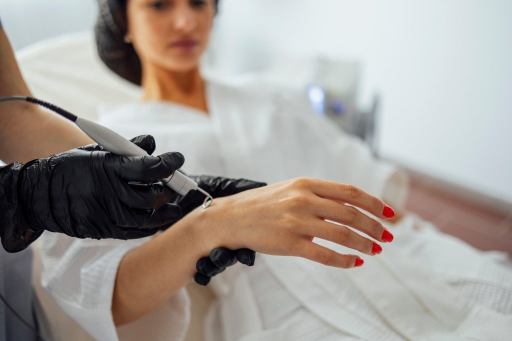 Beautiful caucasian young woman is doing a mole removal procedure