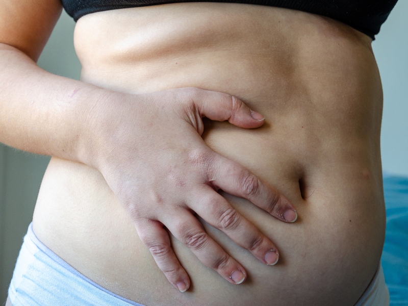 barriga flácida después del parto