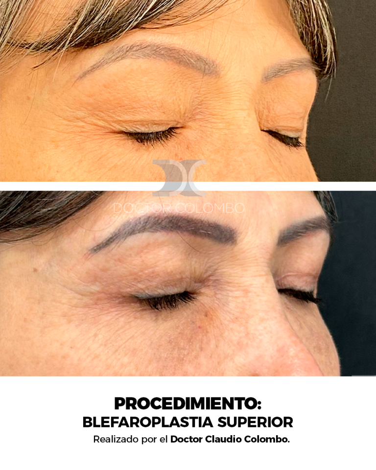 Derecha (1)