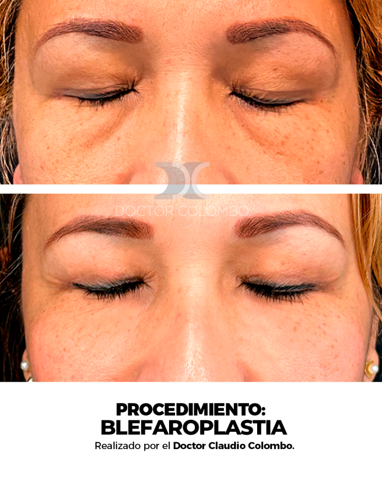 Derecha (2)