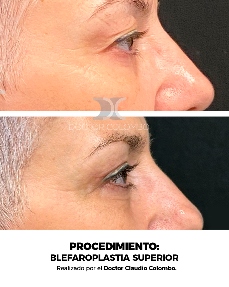 Derecha (3)