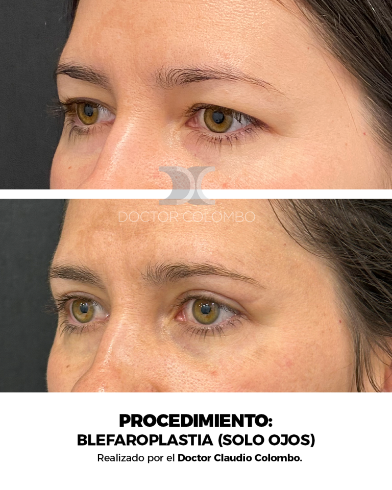 Derecha (4)