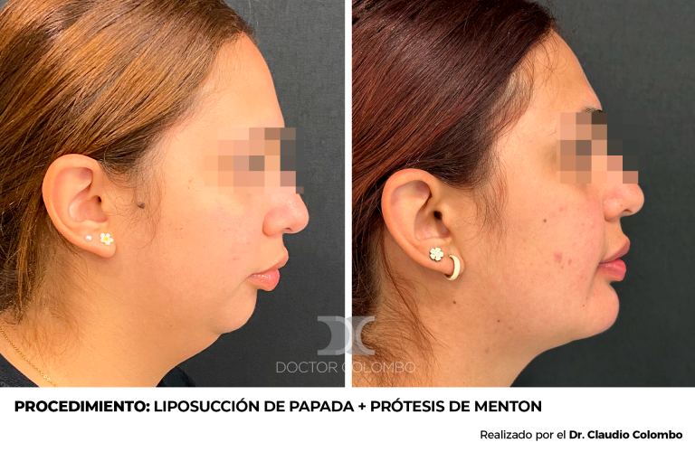 Derecha (6)
