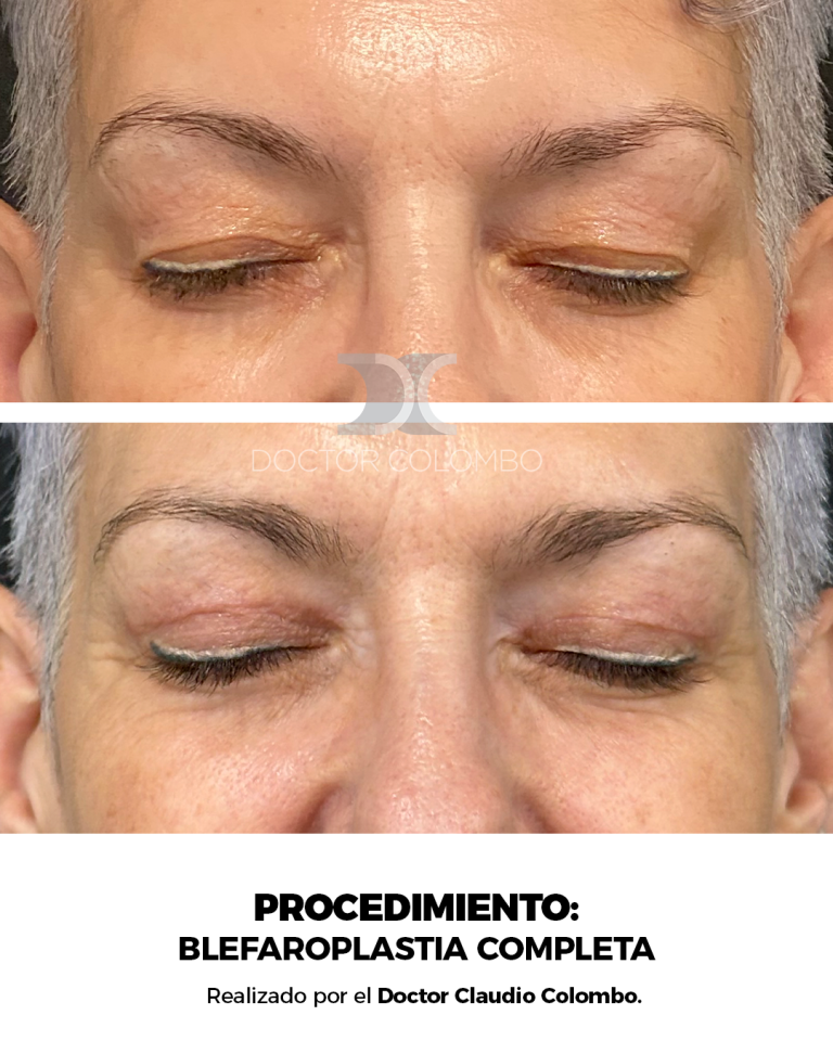 Frontal (1) (1)
