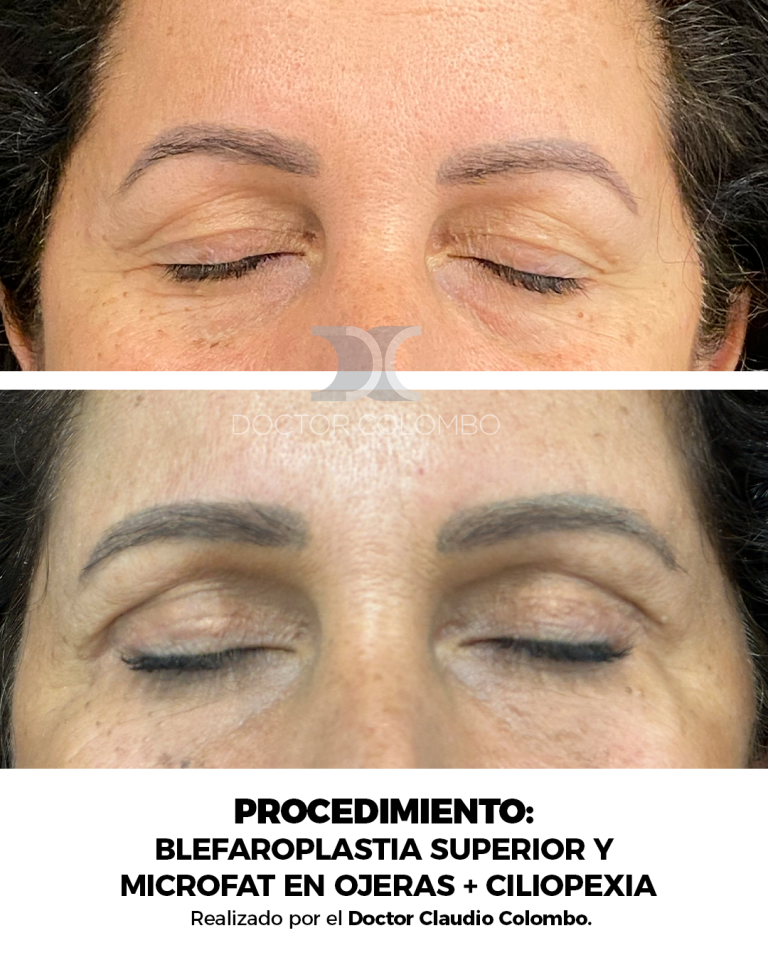 Frontal 2