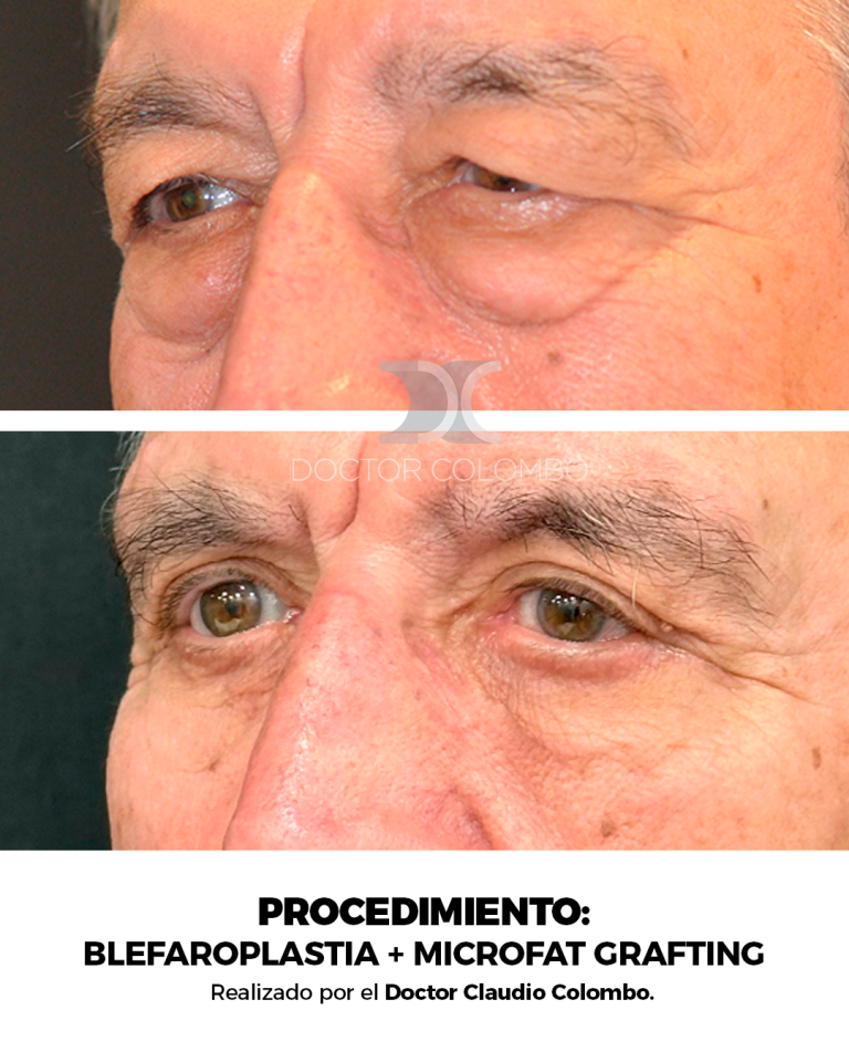 Izquierda 2