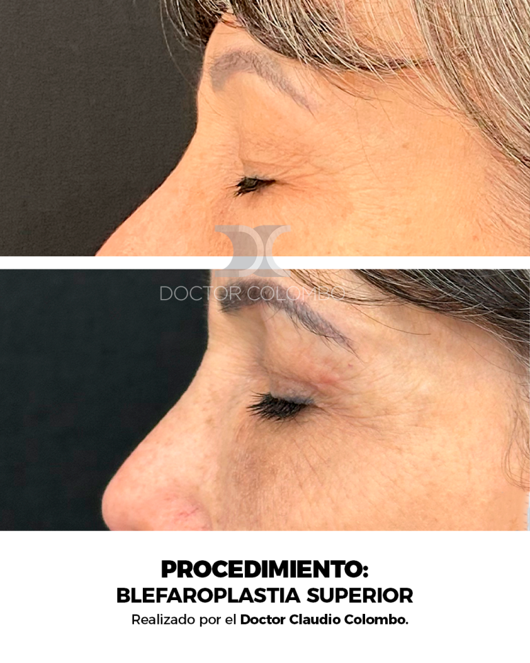 Izquierda (2)