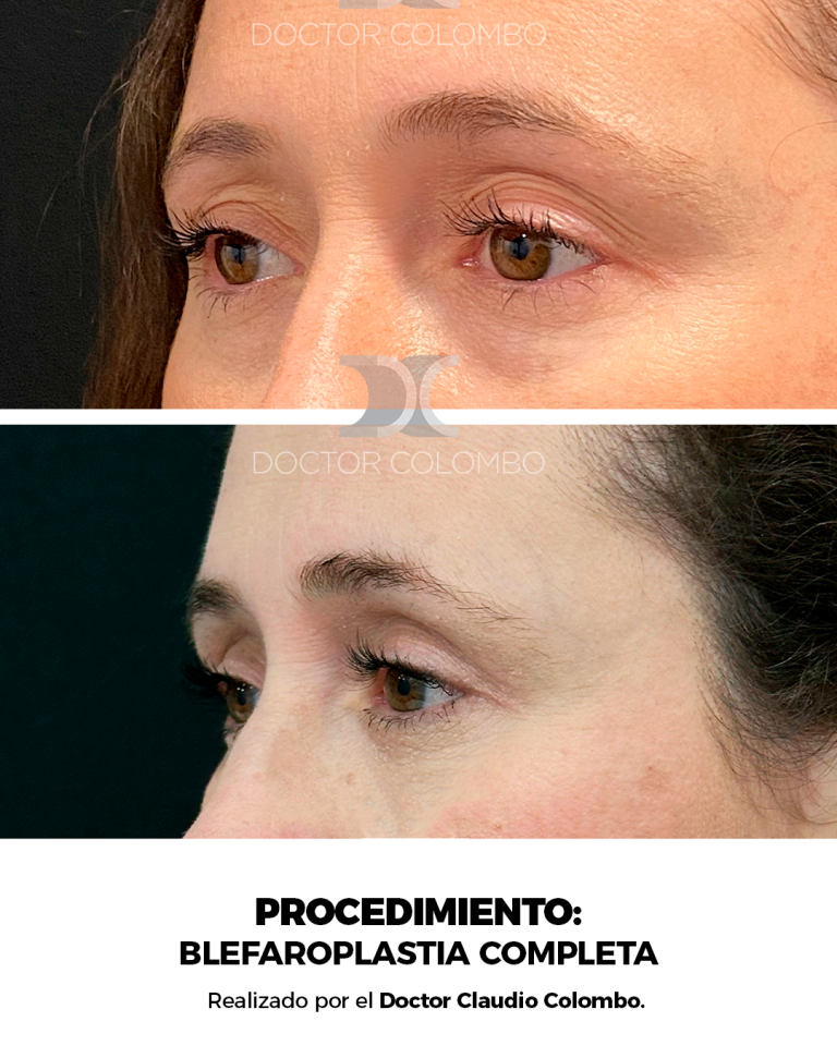 Izquierda (3)