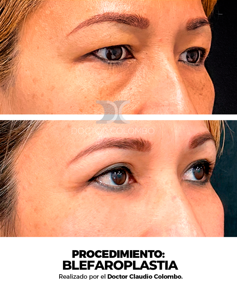 Izquierda (4)