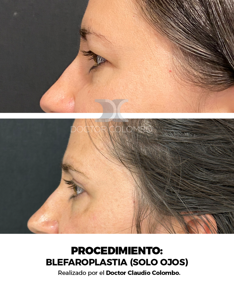Izquierda (6)