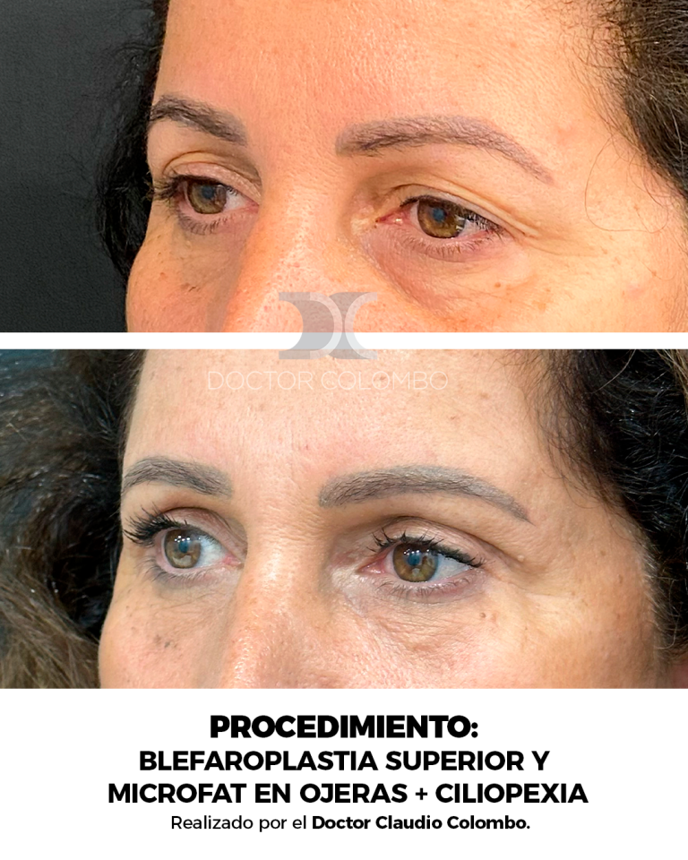 Izquierda (7)