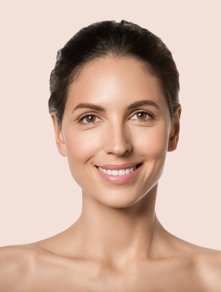 Mujer con resultados naturales tras lifting Deep Plane facial