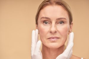 Antes de un tratamiento de lipofilling periocular en Madrid para corregir ojeras hundidas